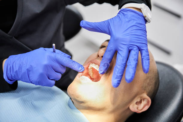 Best Root Canal Emergency Dentist  in Lindstrom, MN